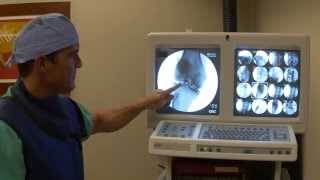 Introduction to fluoroscopic guided injection of stem cells by Harry Adelson ND [upl. by Noislla]