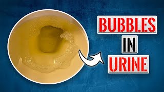 Bubbles in Urine After Peeing What You Should doo [upl. by Warila]