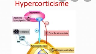 633 MESSAGE IMPORTANT EN CAS DE OBÉSITÉ INFERTILITÉ LE MEILLEUR ANTIRYTHMIQUE AU MONDE CARDIOLOGI [upl. by Vitkun]