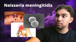 Neisseria Meningitidis  Meningite Meningocócica e Meningococcemia grave [upl. by Enimrac]