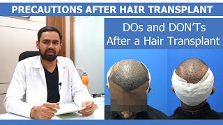 What Precautions Taken After Hair Transplant  Explained by Dr Kiran Chotaliya PartII [upl. by Toor553]