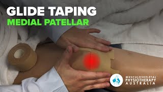 Medial Patellar Glide Taping [upl. by Chessa898]