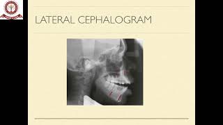 Orthognathic surgery [upl. by Nilrah456]