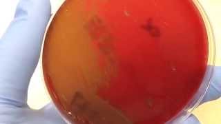 Microbiology  Hemolysis [upl. by Garold]