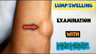 lump examination [upl. by Dagny]