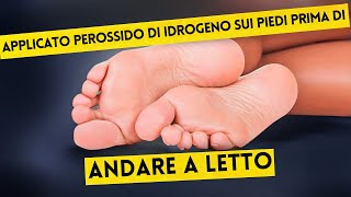 Ecco Cosa è Successo Dopo Solo 2 Volte Perossido di Idrogeno sui Piedi [upl. by Redienhcs736]