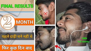 BEARD GROWTH  पहले दाढ़ी घने नहीं थे फिर कुछ दिन बाद  Final beard growth results  दाढ़ी घाना करें [upl. by Lledroc]