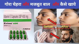 Evion 400 capsule uses in Hindi  Evion 400 capsule  Vitamin E capsule [upl. by Allenotna]