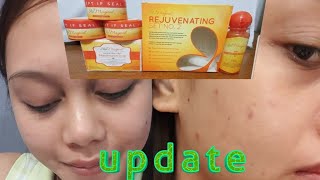 SKIN MAGICAL REJUVENATING SET 2 UPDATEEXPERIENCETIPS [upl. by Loomis869]