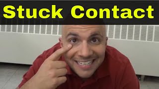 How To Remove A Stuck Contact Lens From Your EyeTutorial [upl. by Robert]