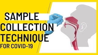 Nasopharyngeal Sample Collection procedure for Covid19 [upl. by Araminta407]