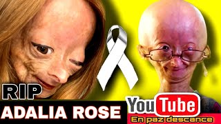 ADALIA ROSE WILLIAMS fallece la Youtuber influencer sufría Síndrome de Progeria HutchinsonGilford [upl. by Sitoiganap]