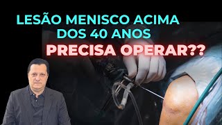 Lesão do menisco acima dos 40 anos de idade Precisa operar [upl. by Douville537]