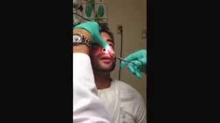 Part 2Nasal Splint Removal quotPULLING OUT WORLDS BIGGEST BOOGERquot WARNING NOT FOR THE SQUEEMISH [upl. by Etennaej]