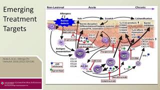 Treatment of ModerateSevere Atopic Dermatitis Line 1 Stop 5 Emerging Treatment Targets V2 [upl. by Rachele633]