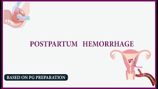 postpartum haemorrhage  NEET PG [upl. by Sanchez]