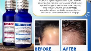 MINOXIDIL 15 hair Tonic  Product Review [upl. by Noek440]