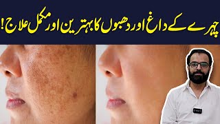 Removal Of Dark Spots And Achieve Clearer Skin  Health Matters [upl. by Ivzt]