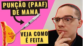 PUNÇÃO PAAF DE MAMA GUIADA POR ULTRASSOM Veja COMO É FEITA e a diferença para a CORE BIOPSY [upl. by Dina]