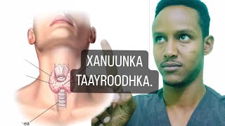 XANUUNKA TAAYROODHKA TYHROID DISEASE [upl. by Hughmanick432]