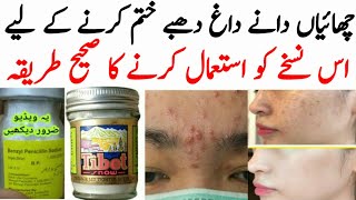 benzyl penicillin injection and tibet cream formula  Sanayya Sadique [upl. by Etnaled949]