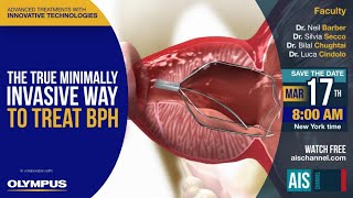 The True Minimally Invasive Way to Treat BPH  Expert Panel Session [upl. by Aloel]