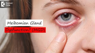 Meibomian Gland Dysfunction MGD amp How it is corrected  Dr Sunita Rana Agarwal  Doctors Circle [upl. by Onit]