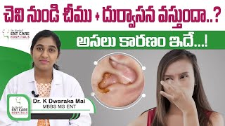 చెవి నుండి చీము  దుర్వాసన  డేంజర్ Cholesteatoma Symptoms amp Treatment  DrHarika ENT CareHospital [upl. by Valenka789]