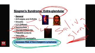 Sjogren syndrome شرح بالعربي [upl. by Ellehsal]