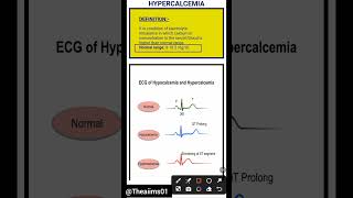 Hypercalcemia☑️hypercalcemiashortsaiimsnorcetmedicalcareerytshortsmedicalmsndisorders [upl. by Hnah]