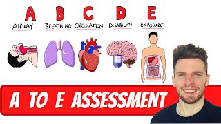 A to E Assessment for Deteriorating and Acutely Unwell Patients  ABDCE Clinical Approach [upl. by Anaira272]