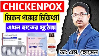 Pox Treatment in Bangla  Chickenpox Treatment  চিকেন পক্স  জলবসন্ত রোগের লক্ষণ ও চিকিৎসা [upl. by Adnawat]