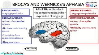 69 SECONDS on BROCAS and WERNICKES APHASIA Never get them mixed up again [upl. by Eerdua]