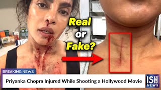 Priyanka Chopra Injured While Shooting a Hollywood Movie  ISH News [upl. by Kenison507]