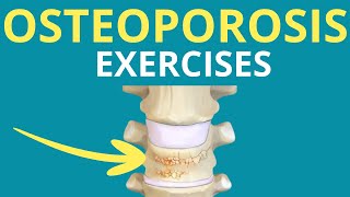 5 Exercises for Osteoporosis [upl. by Rosel]