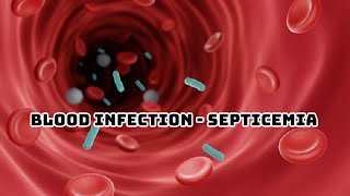 SEPSIS PATHOPHYSIOLOGY OF SEPTICEMIA [upl. by Llehsam]