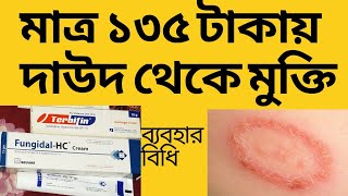 দাউদের সেরা ২ টি মলম। ব্যবহারের নিয়ম। দাম। Ringworm  Tinea treatment [upl. by Madonna]