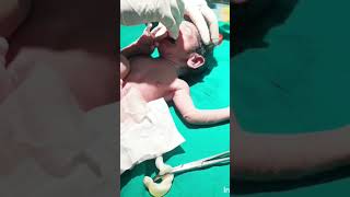 baby suction 🥰😍 so cute newborn baby  aradhna Verma nursing work [upl. by Whiting179]