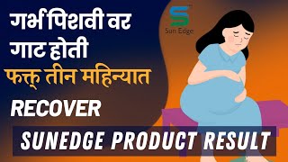 गर्भ पिशवी वर आलेला जबरदस्त Result 😳  sunedge foodsupplements products [upl. by Clemence]