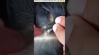 Picking a thousand of lice on hair How to get rid of lice hair wigs newvideolicetok headlice [upl. by Lali]