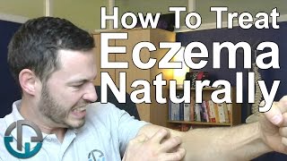 How To Treat Eczema Naturally [upl. by Philipson916]