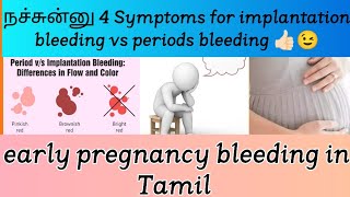 Implantation bleeding symptoms in Tamil  Early pregnancy symptoms in Tamil  My Pregnancy journey [upl. by Rome]