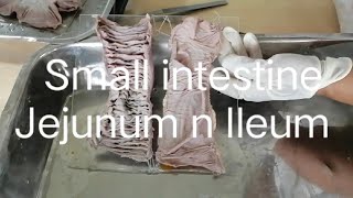 Anatomy of Small intestine jejunum ileum [upl. by Einnos]