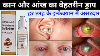 ciplox d eye ear drops  ciprofloxacin dexamethasone eye ear drops ciplox d uses in hindi [upl. by Nolie233]