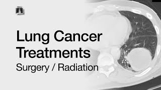 Lung Cancer Treatments Surgery  Radiation [upl. by Kosak]