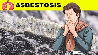 Asbestosis  Causes Pathogenesis Signs amp Symptoms Diagnosis And Treatment [upl. by Accire]