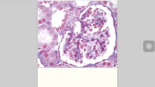 Macula Densa microscopical histology ISM [upl. by Yatnuahc]