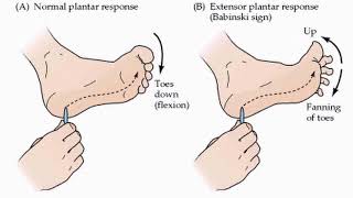 Primitive Reflexes Part 1 [upl. by Yila22]