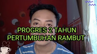 PROGRES 2 TAHUN PERTUMBUHAN RAMBUTMINOXIDIL 5 DAN FINASTERIDE 1MGANDROGENETIC ALOPECIA [upl. by Bonilla822]