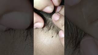 hair headlice barbershop nomorelice hairstyle headliceremoval edsheeren hairlice satisfying [upl. by Ilaw]